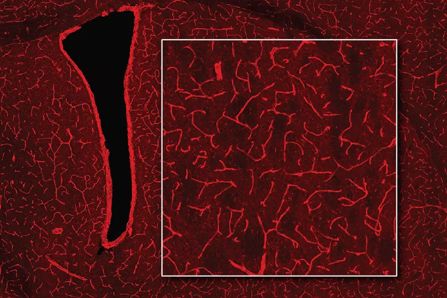 Illuminating the Brain: A New Technique for Deep-Brain Imaging