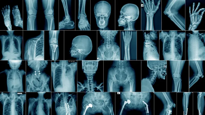 AI’s Demographic Shortcuts Lead to Diagnostic Bias in Medical Image Analysis