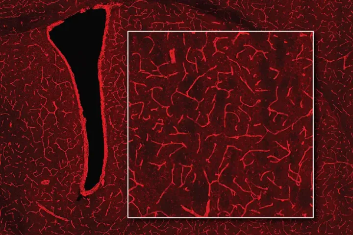 Illuminating the Brain: A New Technique for Deep-Brain Imaging