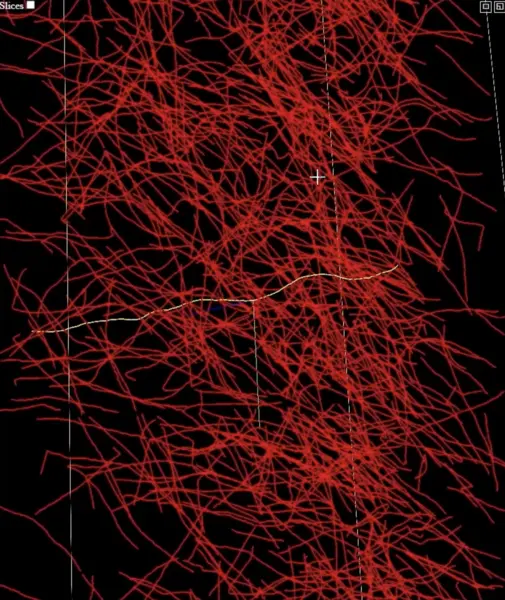 New Open-Source Tool Helps to Detangle the Brain